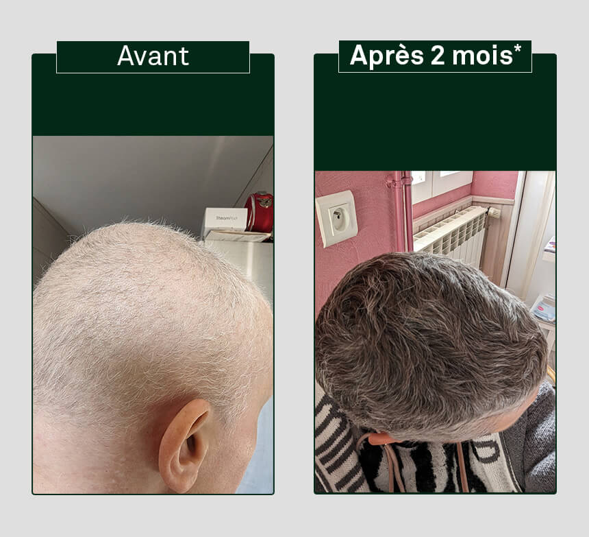 image avant/après